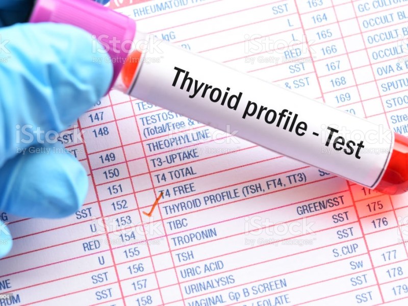 T3 T4 TSH