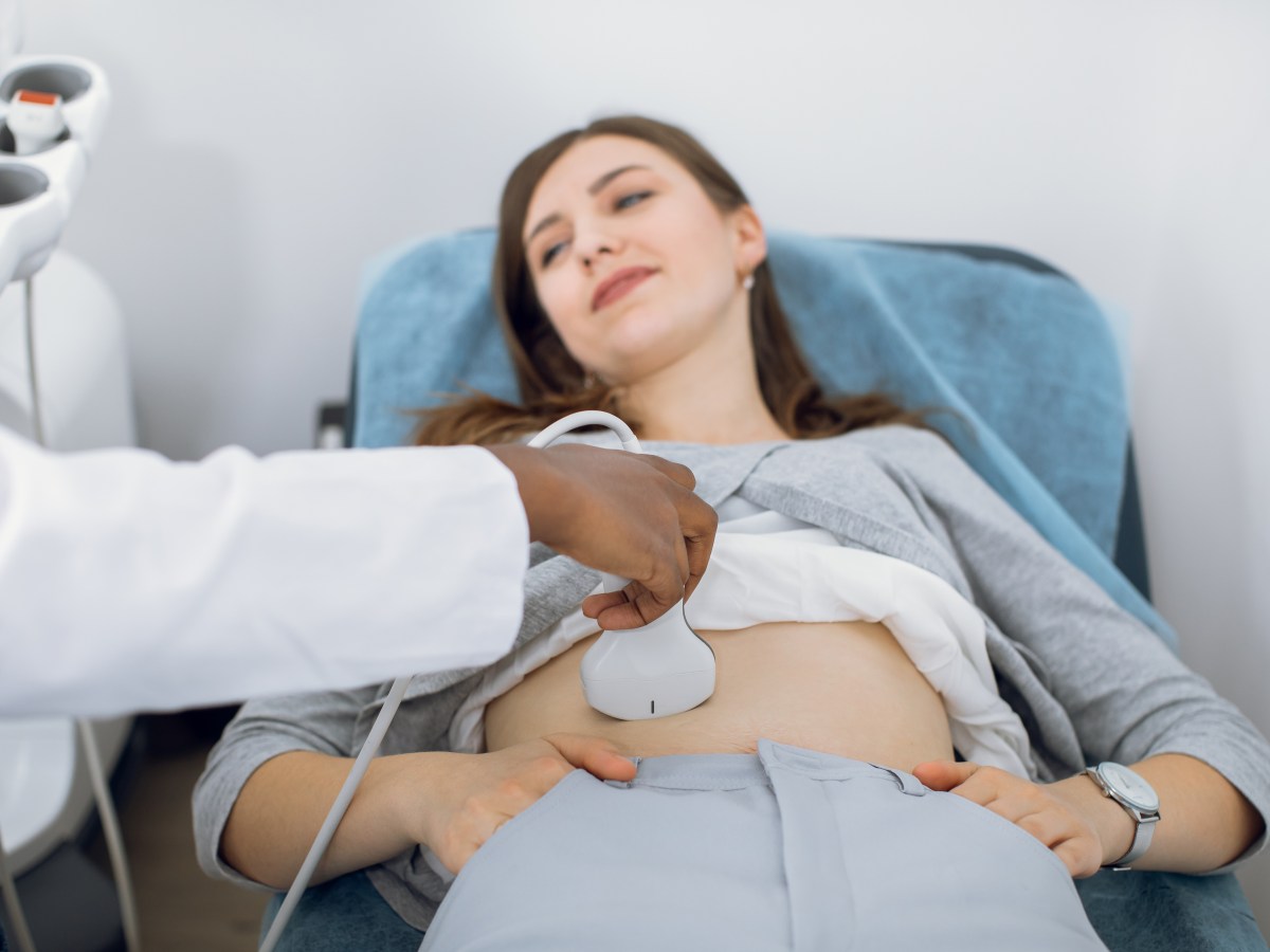 ¿Dónde hacerse un&nbsp;Ultrasonido?