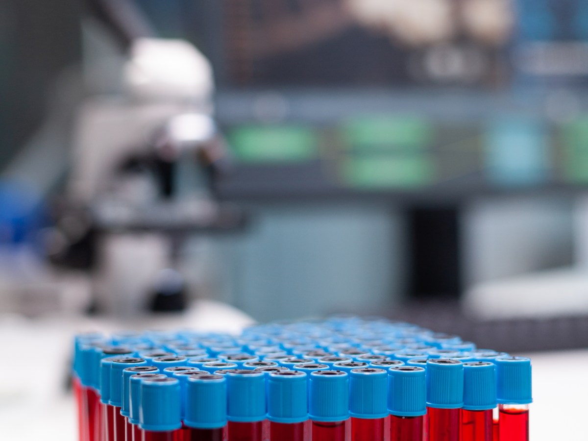 DLH – ¿Importa la&nbsp;medida?